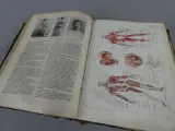 Oud medisch naslagwerk Larousse Médical Illustré uit 1935 – foto 9 – kavel bij De Kringwinkel, Diest