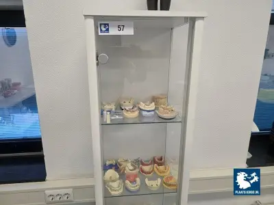 1 x Glazen 1-deurs vitrinekast met tandheelkundige gebitsmodellen en gipsafgietsels – kavel bij Plaats Je Bod, Hoorn